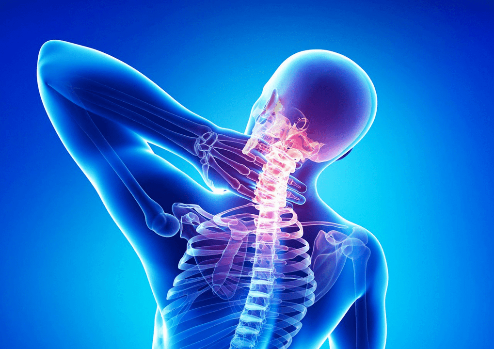 Onurğanın osteoxondrozu