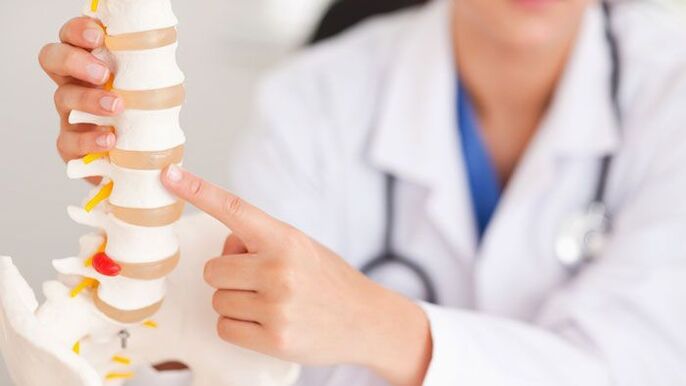 bel modelində bel osteoxondrozunun izahı